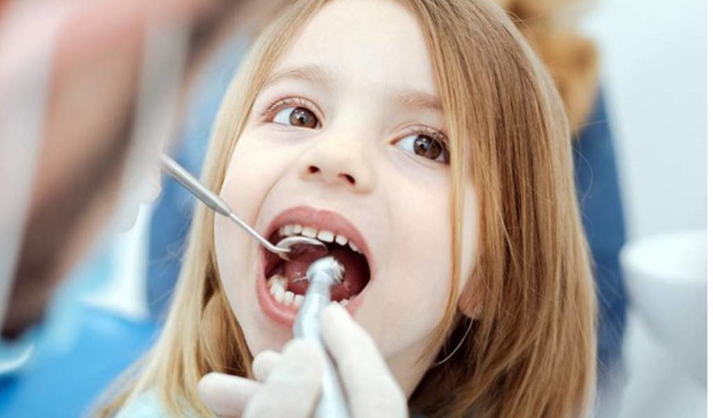 Cara Menghilangkan Karang Gigi yang Membandel